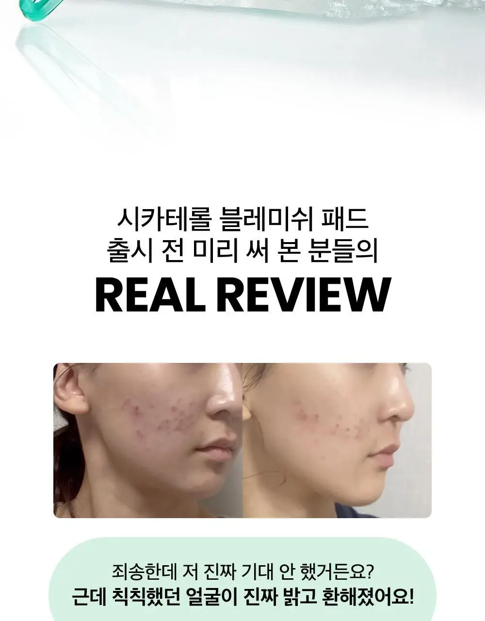 [흔적진정] 비플레인 시카테롤 블레미쉬 패드 80매 상세페이지 4